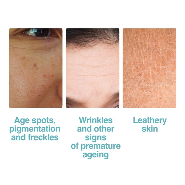 #Sunbed Reel by @irishhealthservice (verified account) - Using sunbeds for the first time before the age of 35 increases your risk of developing melanoma skin cancer by 75%. It is never safe to use a sunbed.