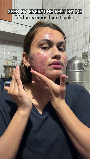 #Selfcare Reel by @ritilokhande_26 - Self-care isn't always gentle.🤍
.
.
.
#viral #pcod #trend #insta #selfcare