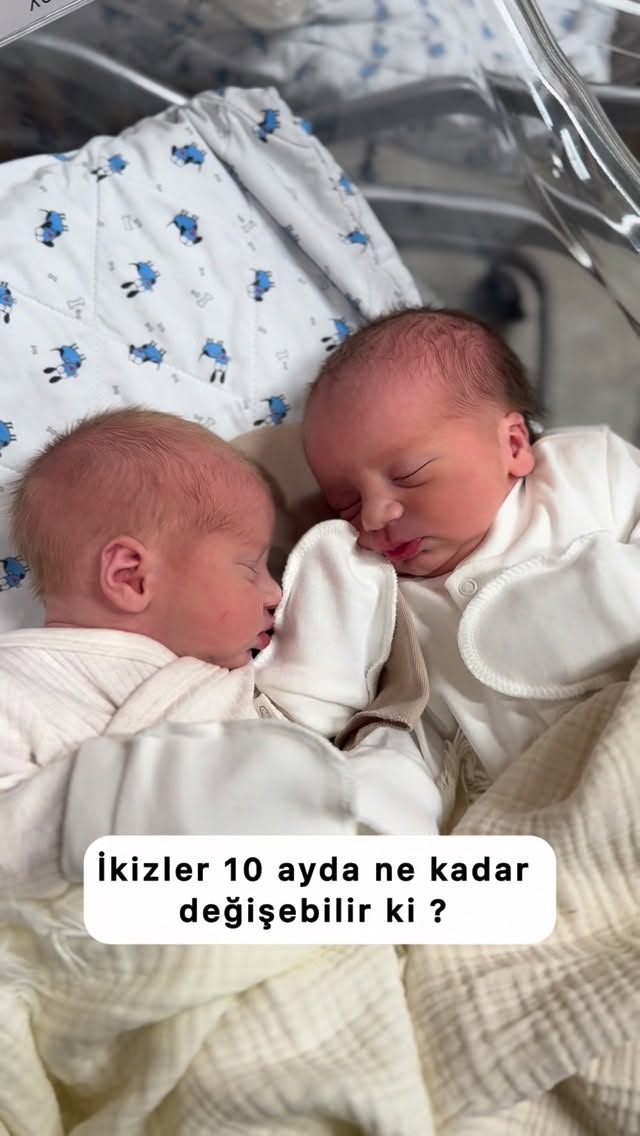 Hangisi daha Γ§ok deΔiΕmiΕ sizce ? . . . . . . . #burcugΓΆΓ§men#twΔ±ns#deΔiΕim#reels