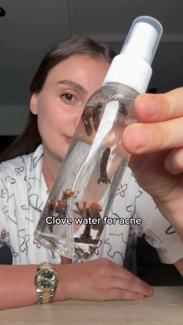 #Acne Reel by @albina - Clove water for acne ✨
#skin #skincare #clove #acne #glow