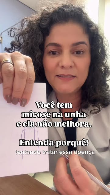 #Micose Reel by @descomplicoferidas - Tratar micose nas unhas é um dos maiores desafios tanto para o profissional da saúde quanto para o paciente.
Entenda porque isso acontece.
#trombose