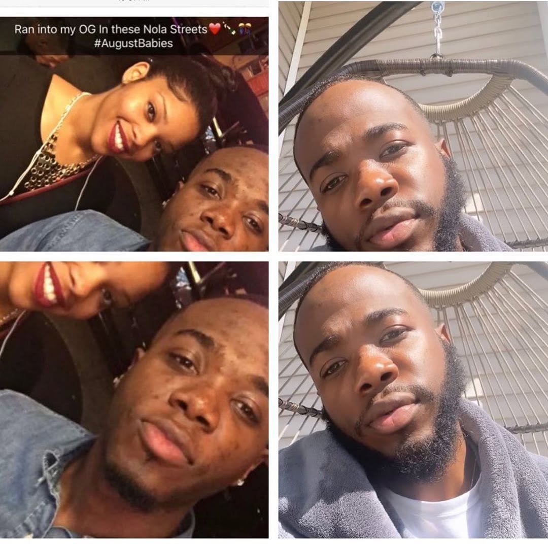 This king used our Extreme Glow Kit and changed his life ❤️ Here’s his story🤴🏾 This was when I first moved to NOLA . I had never experienced any type of serious acne breakouts until I moved here . M