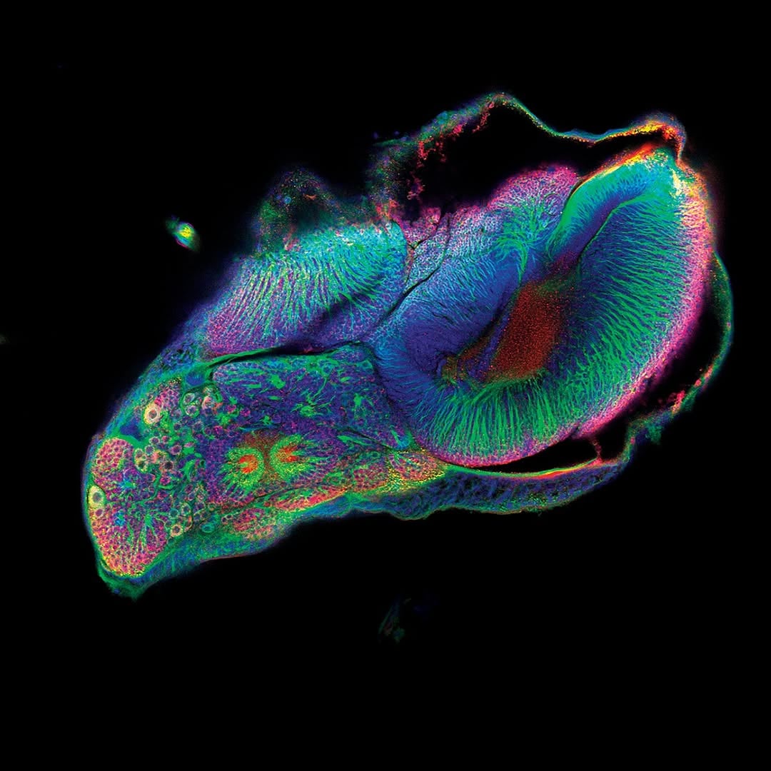 Biologist @amaiaa_alcalde used a powerful laser-scanning microscope to capture images of pupal butterfly brains as they transformed from larvae to adults. To differentiate structures, she stained the