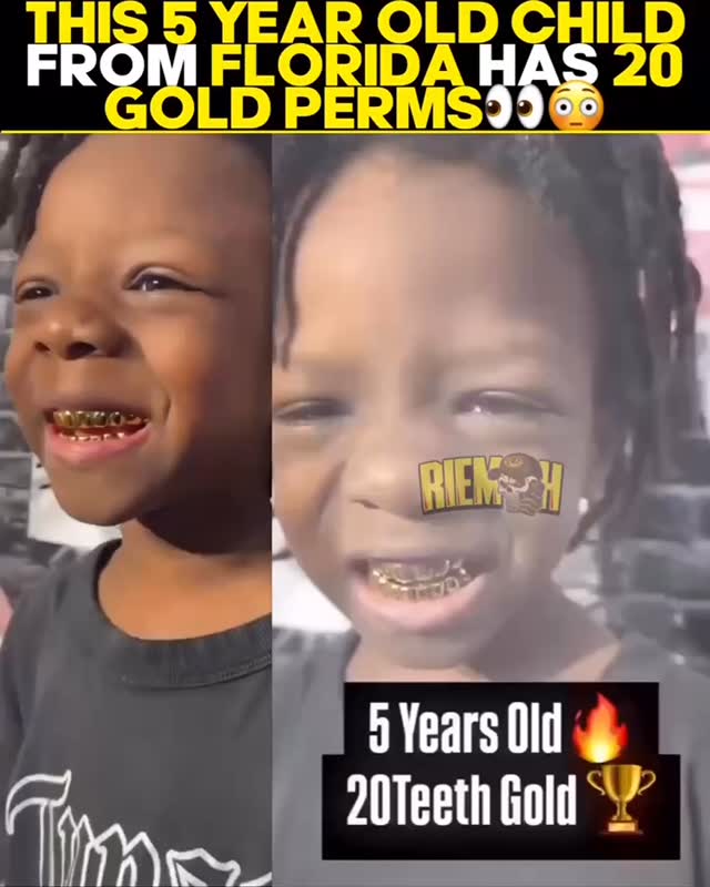 This child from Florida is going viral for having gold teeth so young. Would you get your kid these? π¬ β’@treasuryunderground