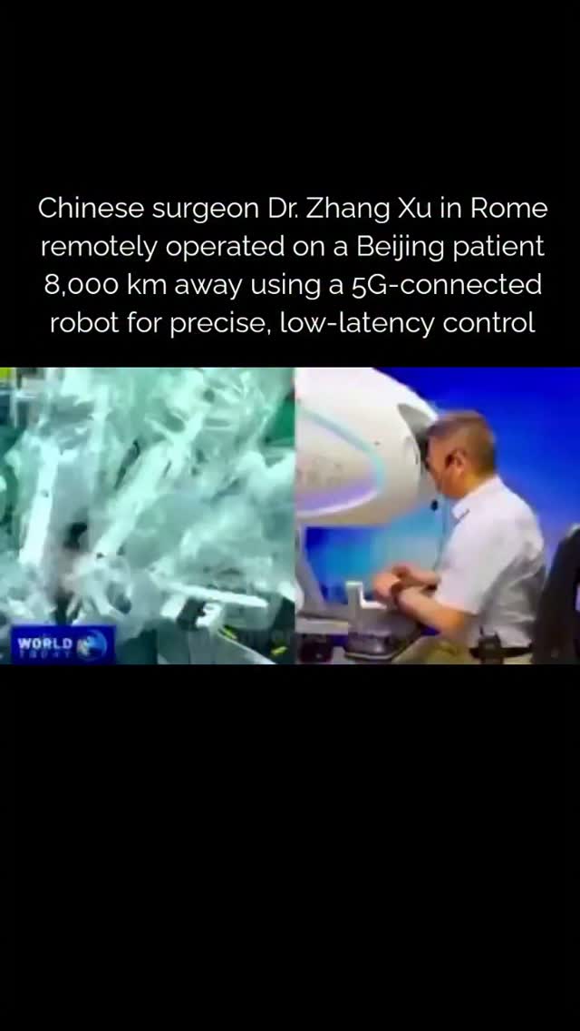 Chinese surgeon Dr. Zhang Xu in Rome remotely operated on a Beijing patient 8,000 km away using a 5G-connected robot for precise, low-latency control.