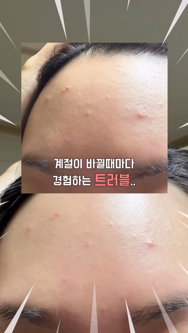 #광고 미세먼지 & 계절이 바뀌면서 민감해진 피부에 더마 진정 솔루션 @aestura.official 붉어진 민감피부 10분체감 손산장벽 개선 리페어크림! 판테놀 & 펩타이드 성분으로 손상된 피부 장벽을 강화해주는 크림인데요~ 가벼우면서 부드러운 발림성이 정말 좋더라구요..🩵 무엇보다 너무 촉촉쓴..! 꾸준히 사용하니 정말 좋아지는게 눈에 확실하게